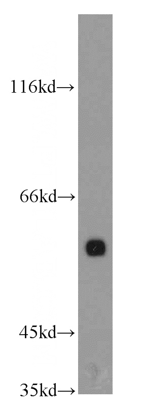 L02 cells were subjected to SDS PAGE followed by western blot with Catalog No:111496(HNF1B antibody) at dilution of 1:800