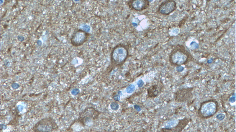 Immunohistochemistry of paraffin-embedded human brain tissue slide using Catalog No:107339(ENO2 Antibody) at dilution of 1:200 (under 40x lens)