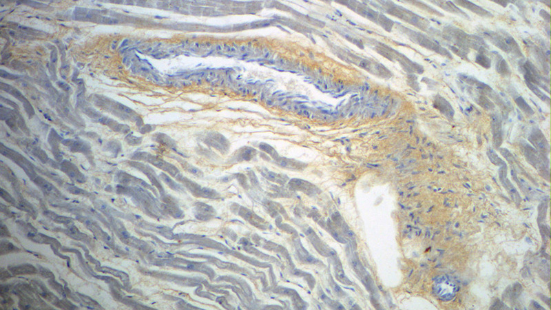 Immunohistochemistry of paraffin-embedded human heart slide using Catalog No:109379(COL4A1 Antibody) at dilution of 1:50 (under 10x lens)