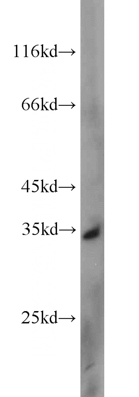 Jurkat cells were subjected to SDS PAGE followed by western blot with Catalog No:116676(UCK2 antibody) at dilution of 1:500