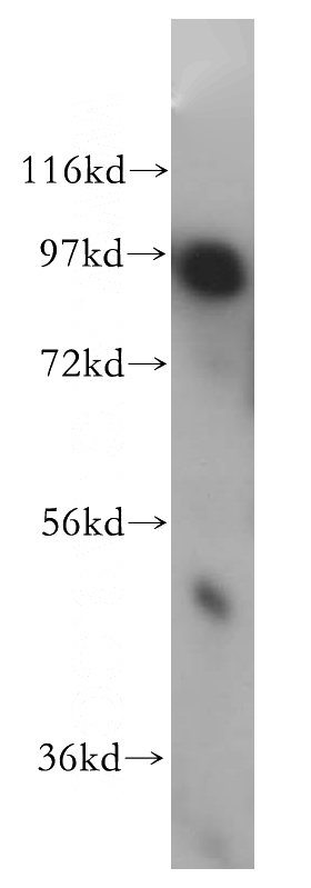 mouse brain tissue were subjected to SDS PAGE followed by western blot with Catalog No:107761(ADAM12 antibody) at dilution of 1:300