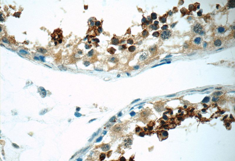 Immunohistochemistry of paraffin-embedded human testis tissue slide using Catalog No:115527(SPACA1 Antibody) at dilution of 1:50 (under 40x lens)