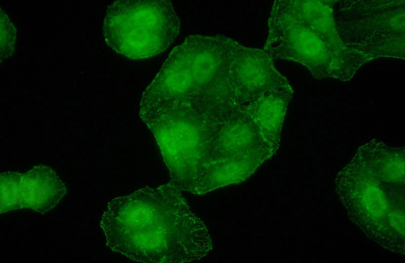 Immunofluorescent analysis of (10% Formaldehyde) fixed A549 cells using Catalog No:114142(PPP1CB Antibody) at dilution of 1:50 and Alexa Fluor 488-congugated AffiniPure Goat Anti-Rabbit IgG(H+L)