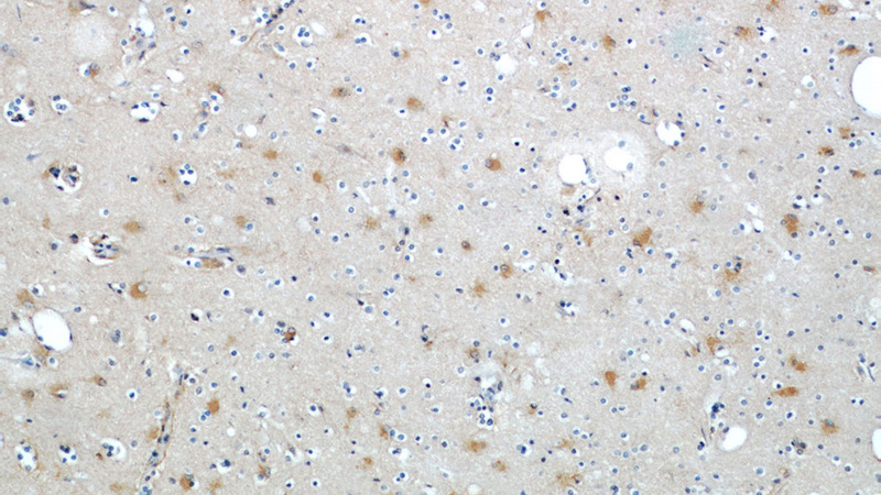 Immunohistochemical of paraffin-embedded human brain using Catalog No:110158(SLC1A2 antibody) at dilution of 1:50 (under 10x lens)
