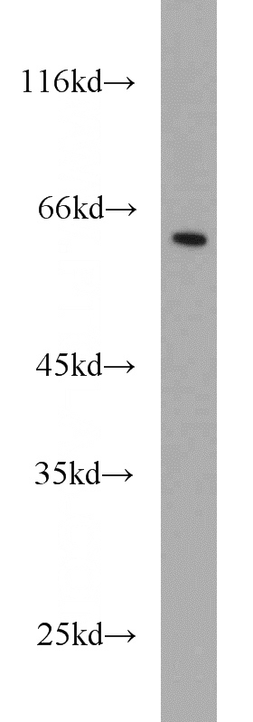 Jurkat cells were subjected to SDS PAGE followed by western blot with Catalog No:112640(MEIS2 antibody) at dilution of 1:500