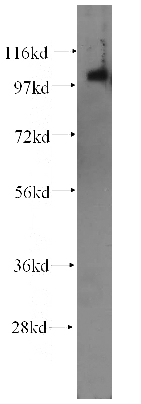 human heart tissue were subjected to SDS PAGE followed by western blot with Catalog No:111959(ITPKC antibody) at dilution of 1:400