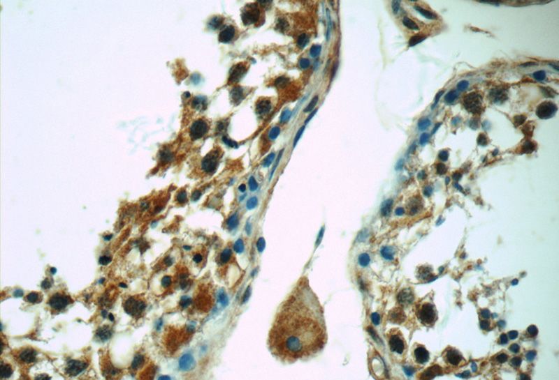 Immunohistochemistry of paraffin-embedded human testis tissue slide using Catalog No:108647(C12orf54 Antibody) at dilution of 1:50 (under 40x lens)