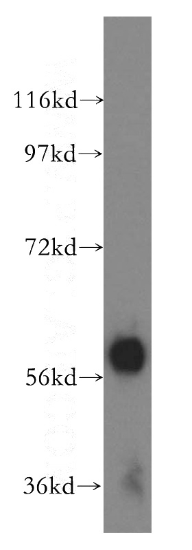 human liver tissue were subjected to SDS PAGE followed by western blot with Catalog No:108014(AMY2A antibody) at dilution of 1:500