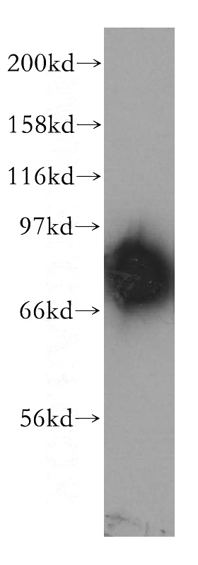 mouse brain tissue were subjected to SDS PAGE followed by western blot with Catalog No:113663(PDE4D antibody) at dilution of 1:400