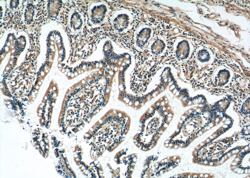 Immunohistochemistry of paraffin-embedded human small intestine tissue slide using Catalog No:108713(C2orf47 Antibody) at dilution of 1:50 (under 10x lens)