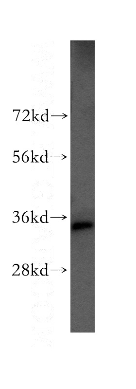 HEK-293 cells were subjected to SDS PAGE followed by western blot with Catalog No:114904(RPLP0 antibody) at dilution of 1:800