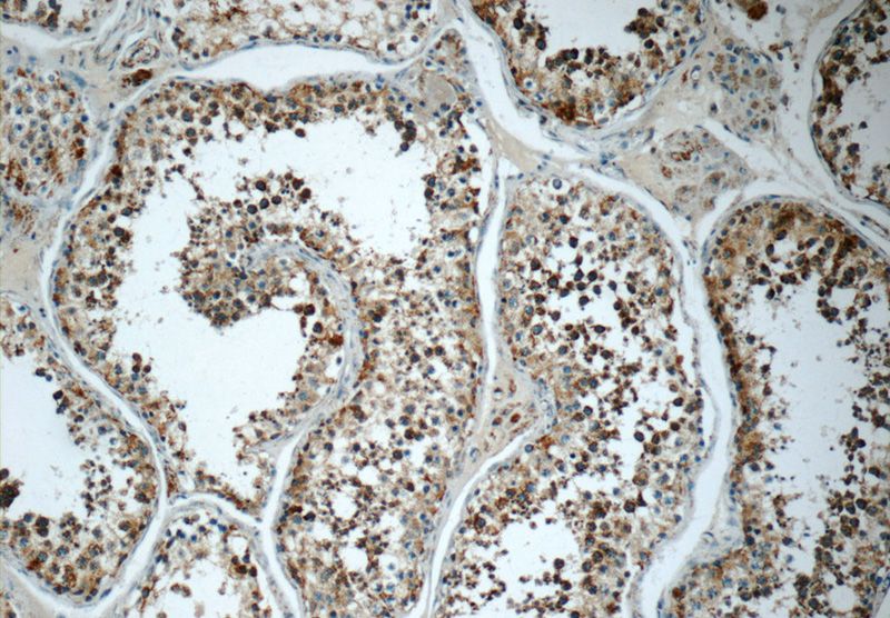 Immunohistochemistry of paraffin-embedded human testis tissue slide using Catalog No:115555(SPATA7 Antibody) at dilution of 1:50 (under 10x lens)