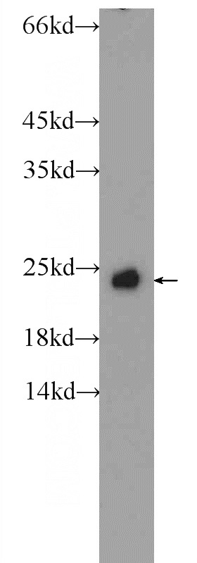 fetal human brain tissue were subjected to SDS PAGE followed by western blot with Catalog No:114452(RAB4A Antibody) at dilution of 1:300