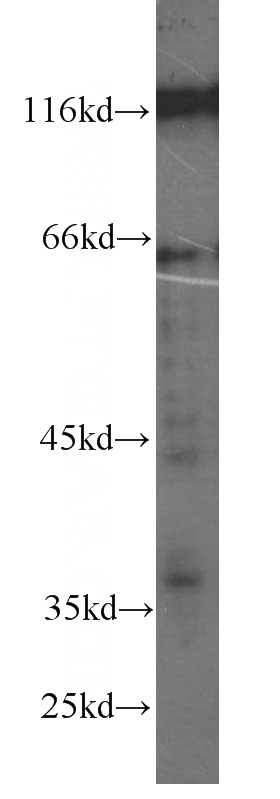 MCF7 cells were subjected to SDS PAGE followed by western blot with Catalog No:107204(FAS antibody) at dilution of 1:500