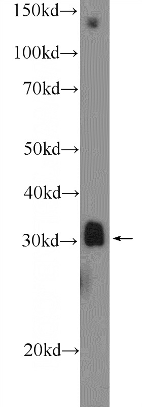 mouse skeletal muscle tissue were subjected to SDS PAGE followed by western blot with Catalog No:112879(MSX1 Antibody) at dilution of 1:1000
