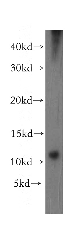 human kidney tissue were subjected to SDS PAGE followed by western blot with Catalog No:112859(MRPS36 antibody) at dilution of 1:300