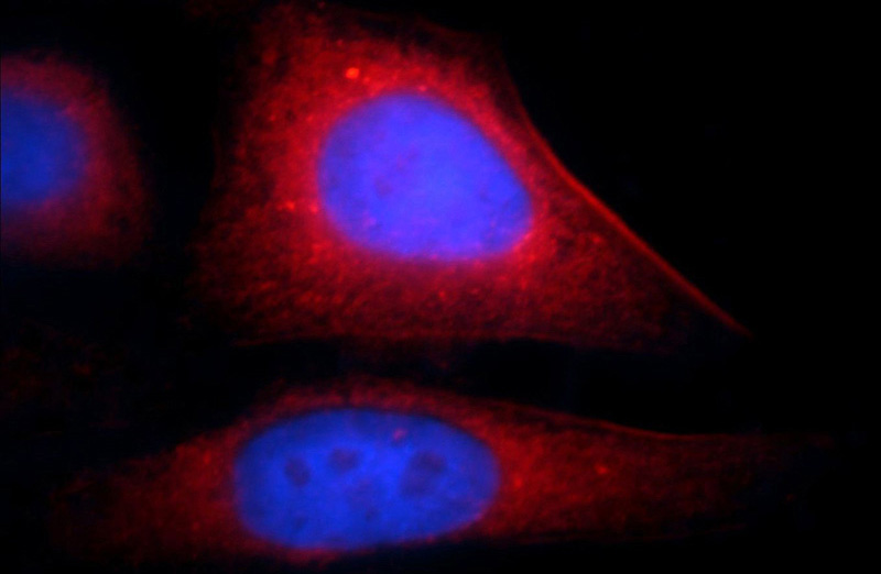 Immunofluorescent analysis of HepG2 cells, using TAGLN2 antibody Catalog No: at 1:25 dilution and Rhodamine-labeled goat anti-rabbit IgG (red). Blue pseudocolor = DAPI (fluorescent DNA dye).