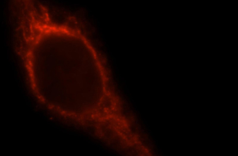 Immunofluorescent analysis of Hela cells, using MAP2K5 antibody Catalog No:112647 at 1:25 dilution and Rhodamine-labeled goat anti-rabbit IgG (red).