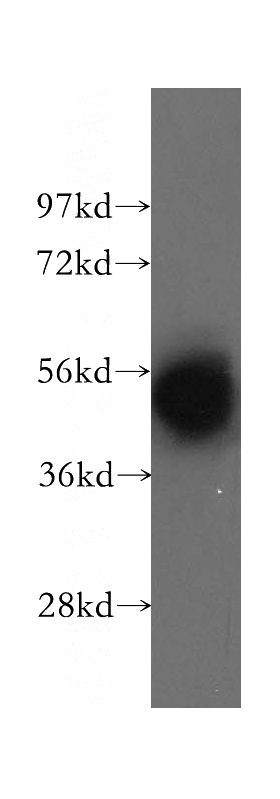 human brain tissue were subjected to SDS PAGE followed by western blot with Catalog No:109881(DBT antibody) at dilution of 1:300