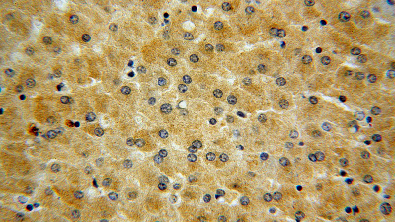 Immunohistochemical of paraffin-embedded human liver using Catalog No:107750(ACOX2 antibody) at dilution of 1:50 (under 40x lens)