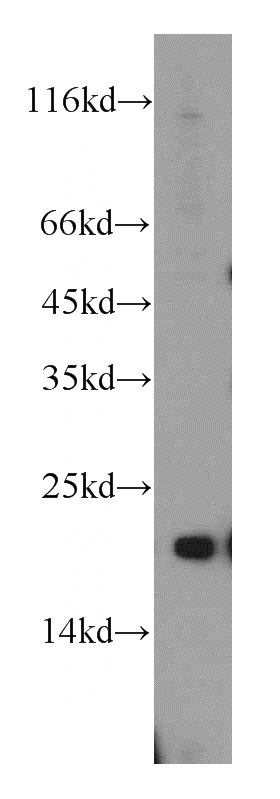 mouse liver tissue were subjected to SDS PAGE followed by western blot with Catalog No:115064(SAR1A antibody) at dilution of 1:500