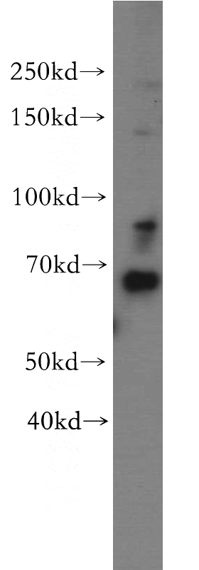 HepG2 cells were subjected to SDS PAGE followed by western blot with Catalog No:113443(NUPL1 antibody) at dilution of 1:500