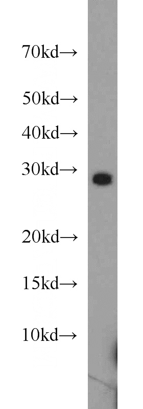mouse skeletal muscle tissue were subjected to SDS PAGE followed by western blot with Catalog No:114080(PPAPDC3 antibody) at dilution of 1:800