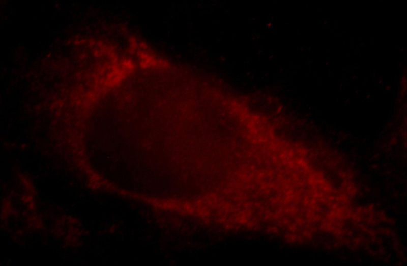 Immunofluorescent analysis of Hela cells, using KIAA1191 antibody Catalog No:111989 at 1:25 dilution and Rhodamine-labeled goat anti-rabbit IgG (red).