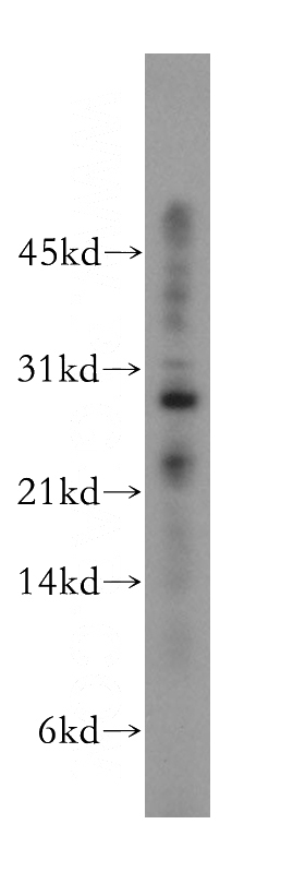 HEK-293 cells were subjected to SDS PAGE followed by western blot with Catalog No:114725(RNASET2 antibody) at dilution of 1:500