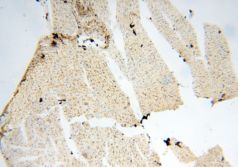 Immunohistochemical of paraffin-embedded human heart using Catalog No:111158(PCDGF,GRN antibody) at dilution of 1:50 (under 10x lens)