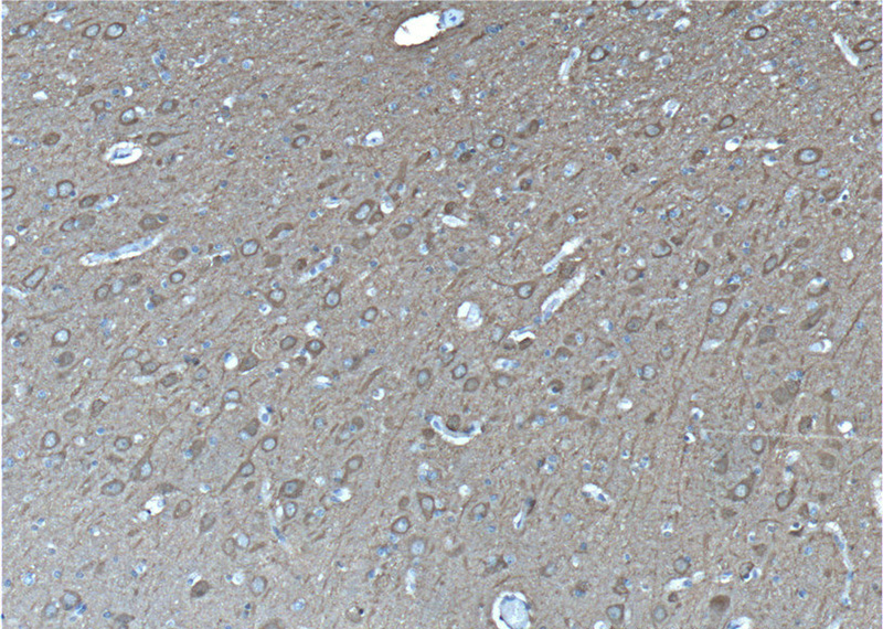 Immunohistochemistry of paraffin-embedded human brain tissue slide using Catalog No:107339(ENO2 Antibody) at dilution of 1:200 (under 10x lens)
