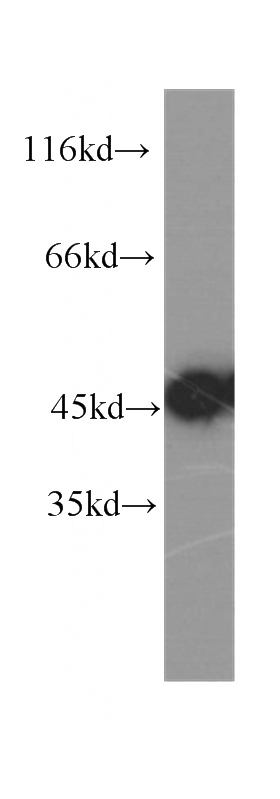 HeLa cells were subjected to SDS PAGE followed by western blot with Catalog No:107349(INHBA antibody) at dilution of 1:500