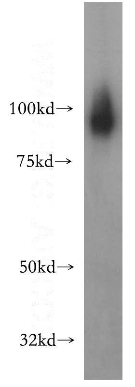 human brain tissue were subjected to SDS PAGE followed by western blot with Catalog No:114977(SATB1 antibody) at dilution of 1:4000