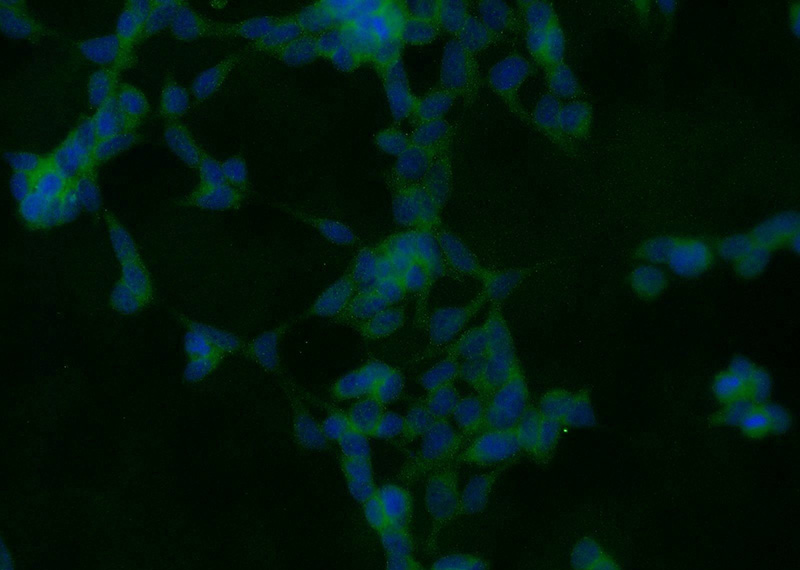 Immunofluorescent analysis of HEK-293 cells using Catalog No:114984(SCAP Antibody) at dilution of 1:25 and Alexa Fluor 488-congugated AffiniPure Goat Anti-Rabbit IgG(H+L)