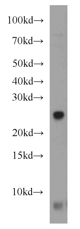 Jurkat cells were subjected to SDS PAGE followed by western blot with Catalog No:113363(NUDT8 antibody) at dilution of 1:1500