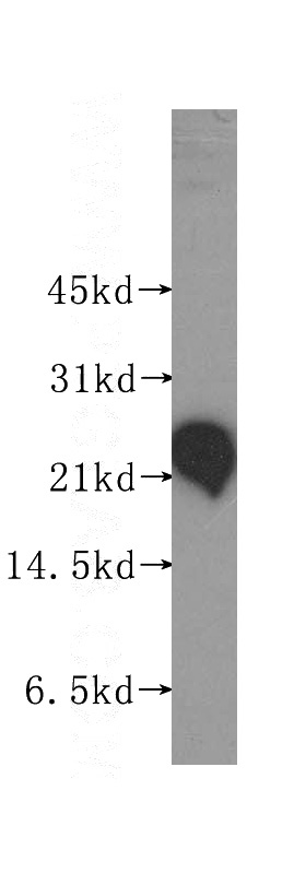 HeLa cells were subjected to SDS PAGE followed by western blot with Catalog No:114863(RTN3 antibody) at dilution of 1:400