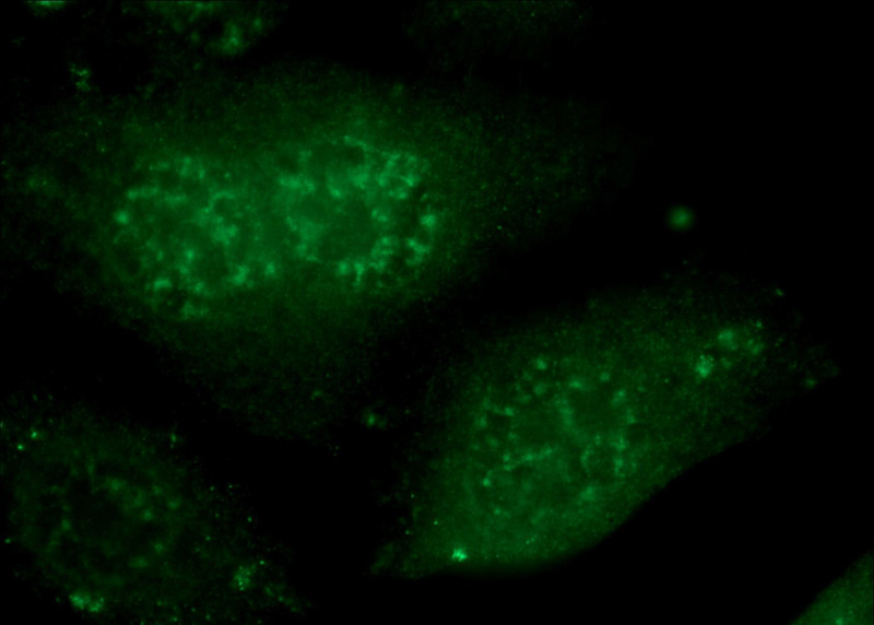 Immunofluorescent analysis of HepG2 cells using Catalog No:116048(THoc5 Antibody) at dilution of 1:25 and Alexa Fluor 488-congugated AffiniPure Goat Anti-Rabbit IgG(H+L)