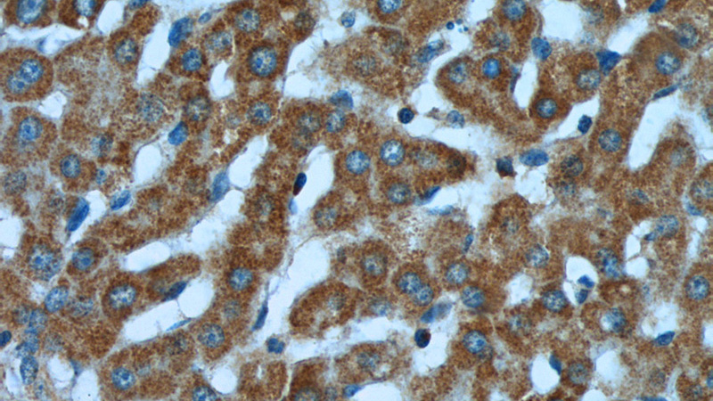 Immunohistochemistry of paraffin-embedded human liver tissue slide using Catalog No:112100(KLHL28 Antibody) at dilution of 1:50 (under 40x lens)