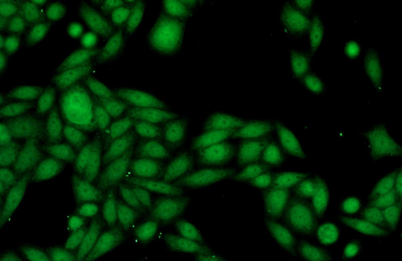 Immunofluorescent analysis of HeLa cells using Catalog No:115605(SSB Antibody) at dilution of 1:50 and Alexa Fluor 488-congugated AffiniPure Goat Anti-Rabbit IgG(H+L)