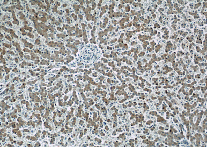 Immunohistochemistry of paraffin-embedded human liver slide using Catalog No:108023(APOB Antibody) at dilution of 1:50