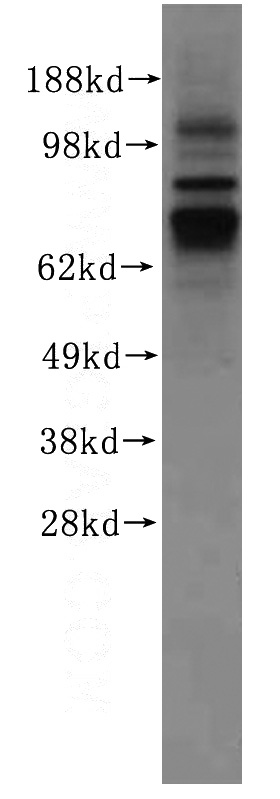 human skeletal muscle tissue were subjected to SDS PAGE followed by western blot with Catalog No:110596(FAM65B antibody) at dilution of 1:500