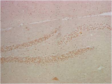 IHC staining of mouse hippocampus tissue with NF-κB p65 mouse mAb(14H2) diluted at 1:200.
