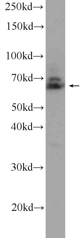 HeLa cells were subjected to SDS PAGE followed by western blot with Catalog No:108066(ANKRD13A Antibody) at dilution of 1:300