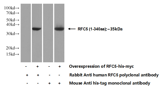 Transfected HEK-293 cells were subjected to SDS PAGE followed by western blot with Catalog No:114626(RFC5 Antibody) at dilution of 1:1000