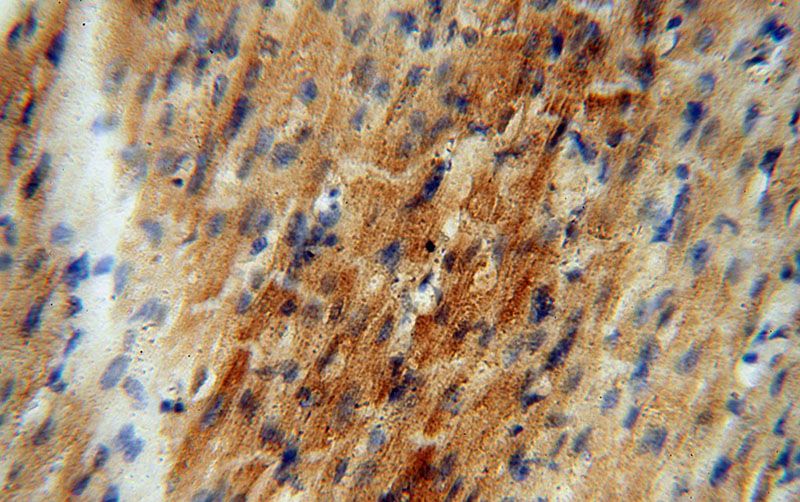 Immunohistochemical of paraffin-embedded human heart using Catalog No:114568(RBX1 antibody) at dilution of 1:50 (under 40x lens)