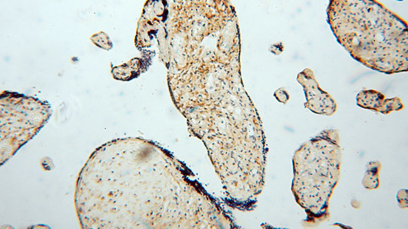 Immunohistochemical of paraffin-embedded human placenta using Catalog No:113242(NLRP2 antibody) at dilution of 1:50 (under 10x lens)