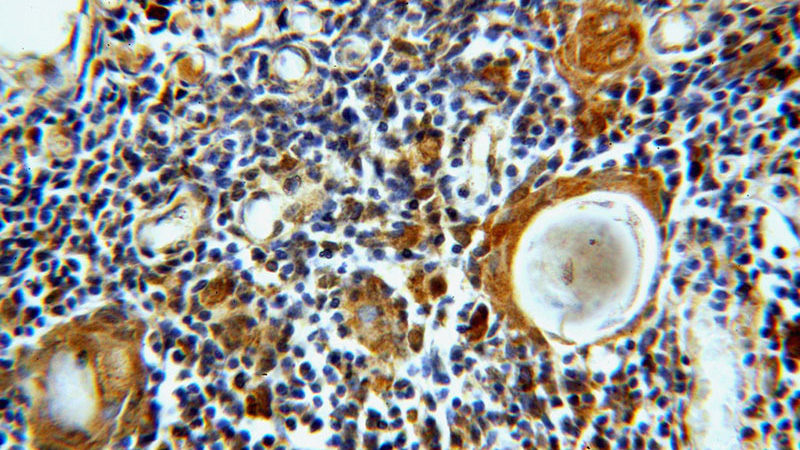 Immunohistochemical of paraffin-embedded human thymus using Catalog No:112191(LEF1 antibody) at dilution of 1:100 (under 40x lens)