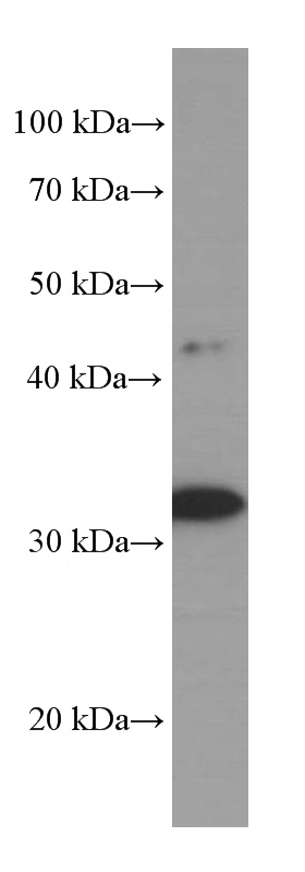 pig stomach tissue were subjected to SDS PAGE followed by western blot with Catalog No:107166(CNN2 Antibody) at dilution of 1:2000