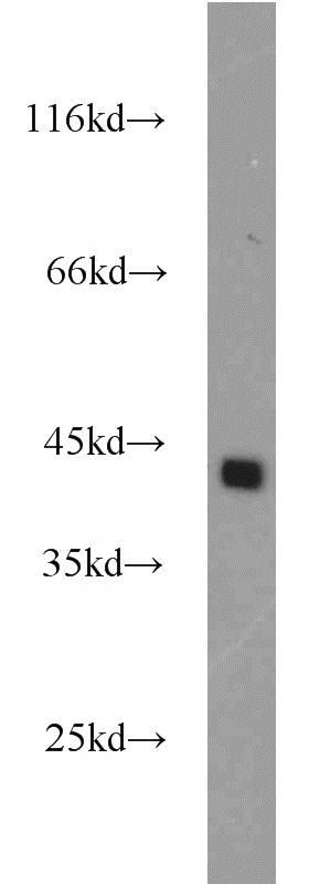 HEK-293 cells were subjected to SDS PAGE followed by western blot with Catalog No:109901(DFFA,DFF45 antibody) at dilution of 1:1000