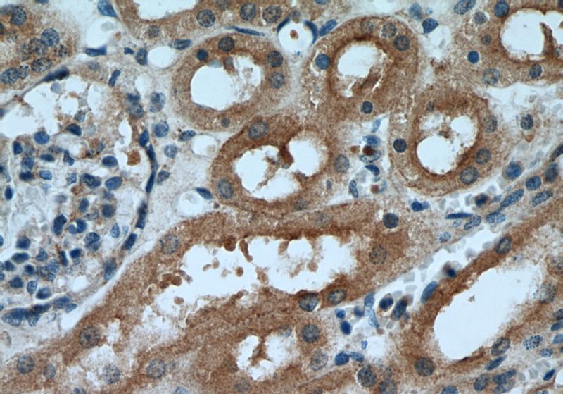 Immunohistochemical of paraffin-embedded human kidney using Catalog No:111600(IDE antibody) at dilution of 1:50 (under 40x lens)